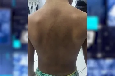 MENINO DE 3 ANOS É RESGATADO COM FERIMENTOS PELO CORPO; MÃE E PADRASTO SÃO PRESOS EM MACEIÓ