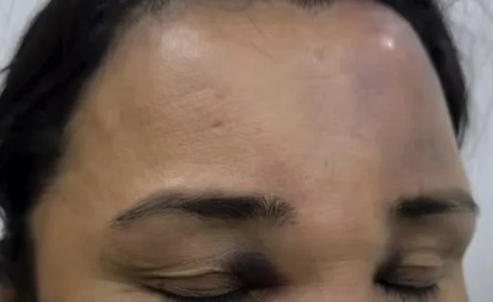 SSP INVESTIGA DENÚNCIA DE AGRESSÃO CONTRA MULHER ENVOLVENDO POLICIAIS DO BOPE DURANTE FESTA JUNINA EM MACEIÓ