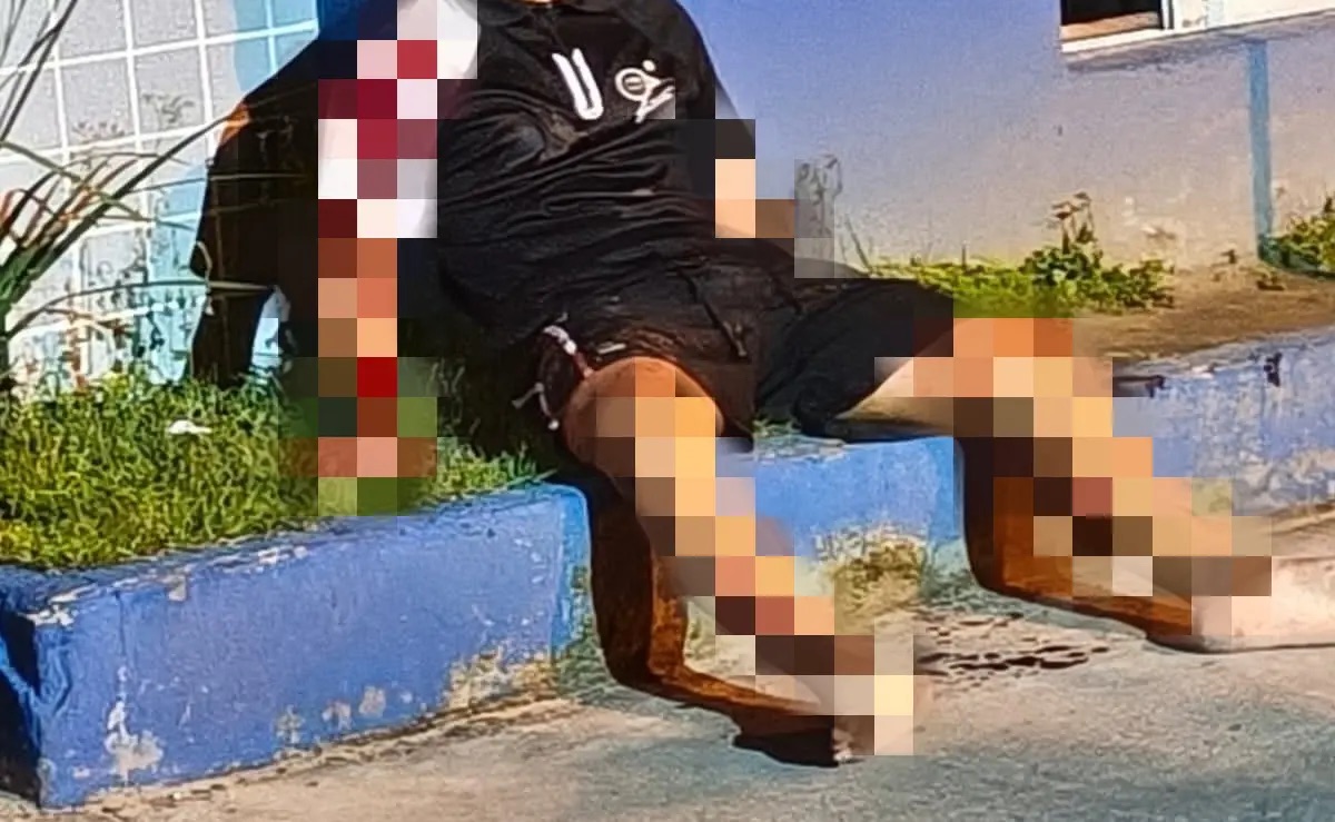 ADOLESCENTE LEVA DOIS TIROS NA CABEÇA, FINGE ESTAR MORTO E CONSEGUE ESCAPAR DE EXECUÇÃO EM MACEIÓ