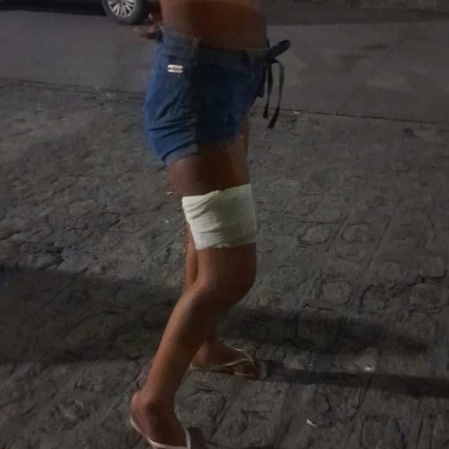POLÍCIA MILITAR INVESTIGA OCORRÊNCIA QUE DEIXOU DUAS MENORES FERIDAS NO VERGEL